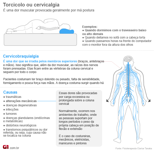 Torcicolodois
